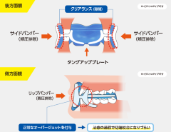 プレオルソ